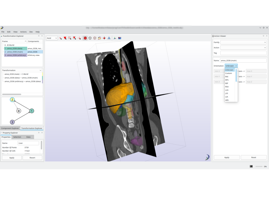 Anatomical orientation in CamiTK 