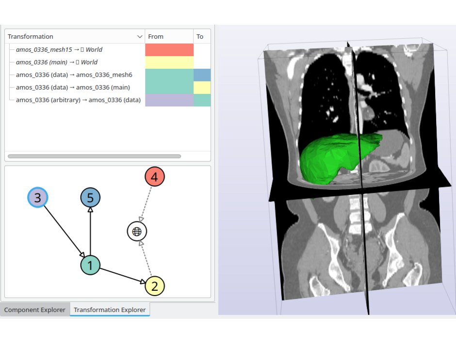 Mesh and CT image after registration 