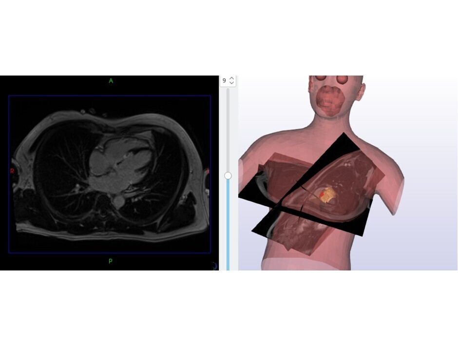 A cardiac project using CamiTK 